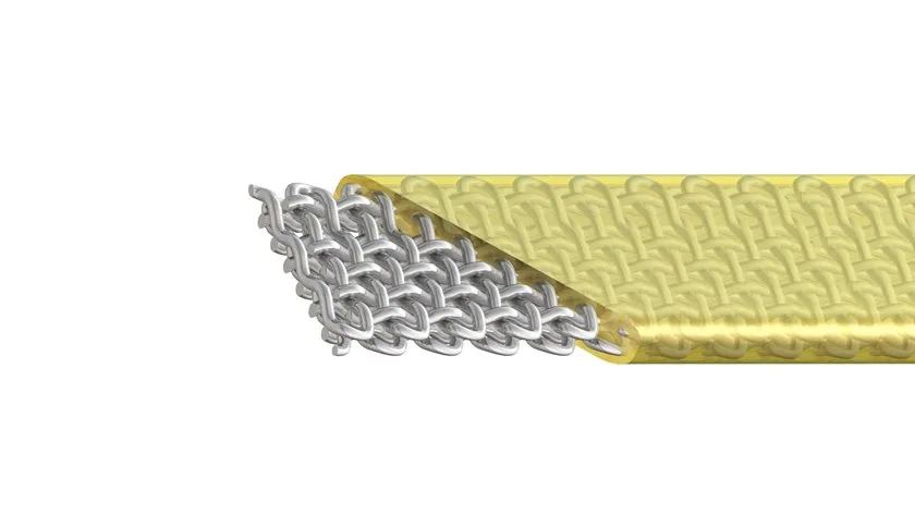 Dentapreg® BRAID