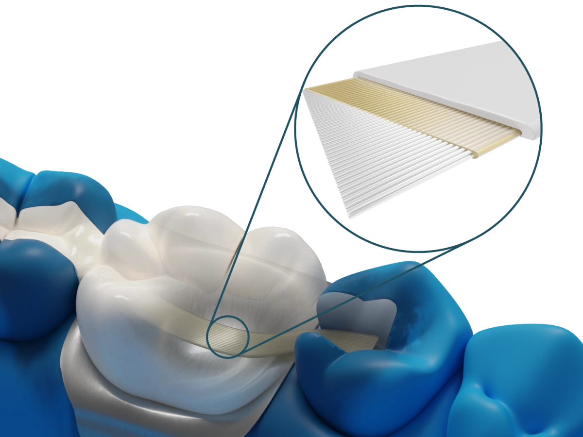 Dentapreg® BUNDLE