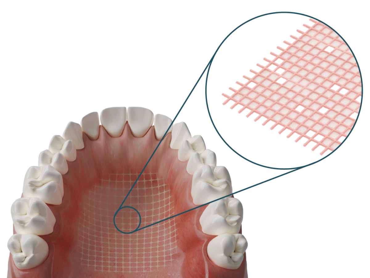 Dentapreg® MESH PINK