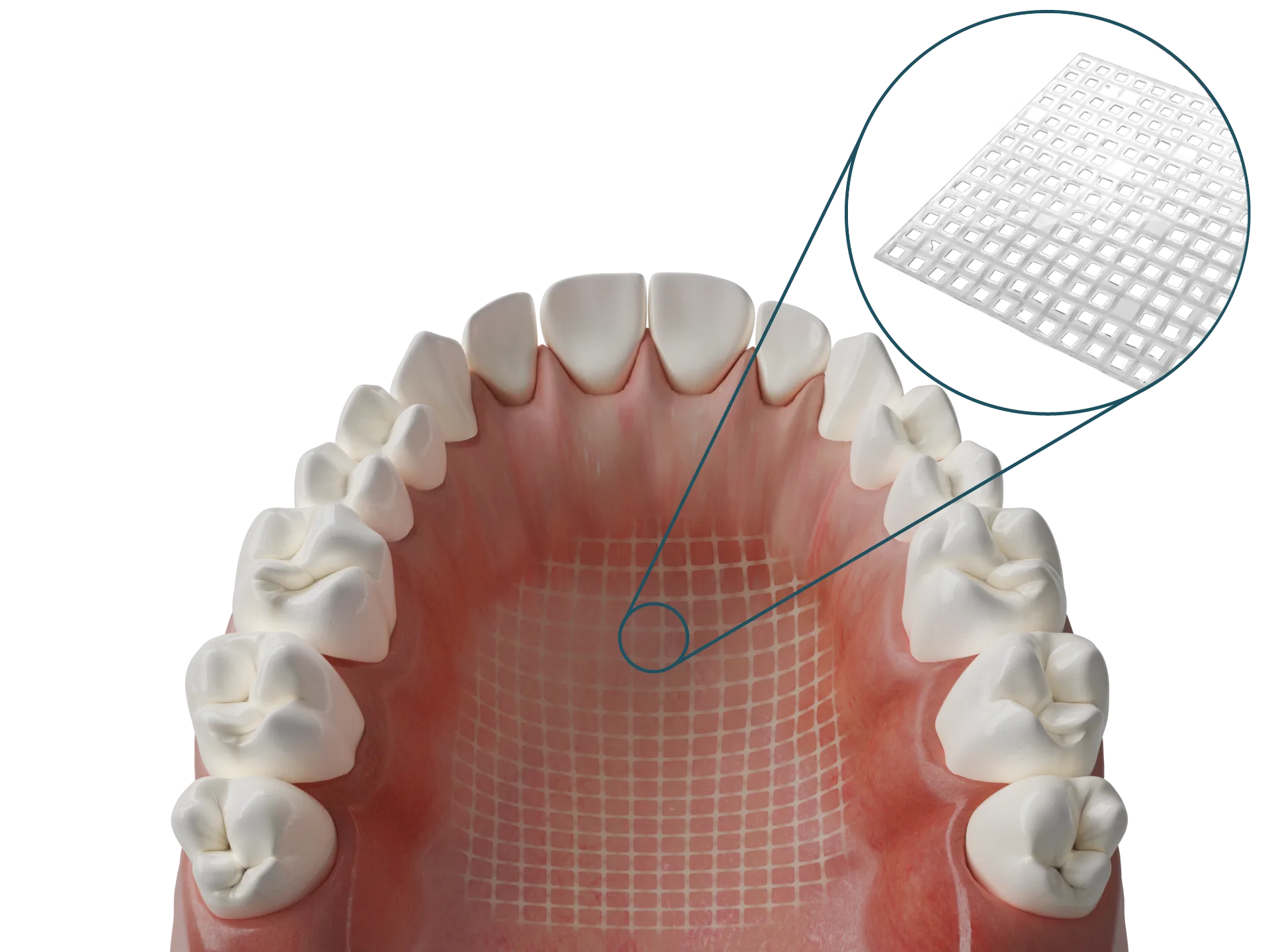 Dentapreg® MESH Transparent