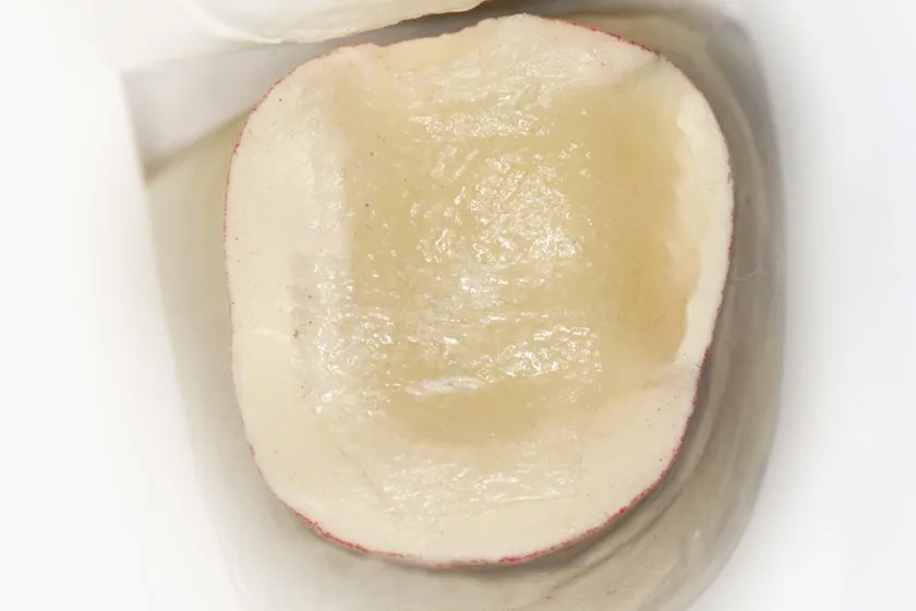 Dentapreg® VEIL
