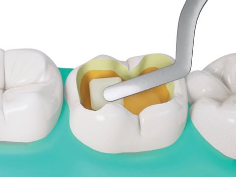 Fibrafill® CUBE